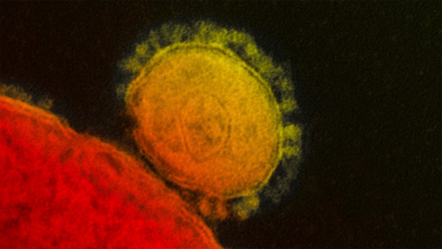 Fransada koronavirusa yoluxanların sayı beş nəfərə çatıb