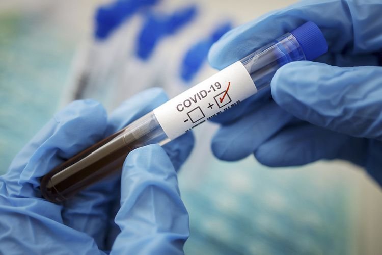 Gürcüstanda koronavirusa yoluxanların sayı 746-ya çatdı