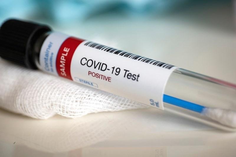Yaponiyada koronavirusa yoluxanların sayı 20 mini keçdi