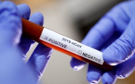  Yeni koronavirus dərmanı dayanıqlı immunitet yaradır - MÜJDƏ