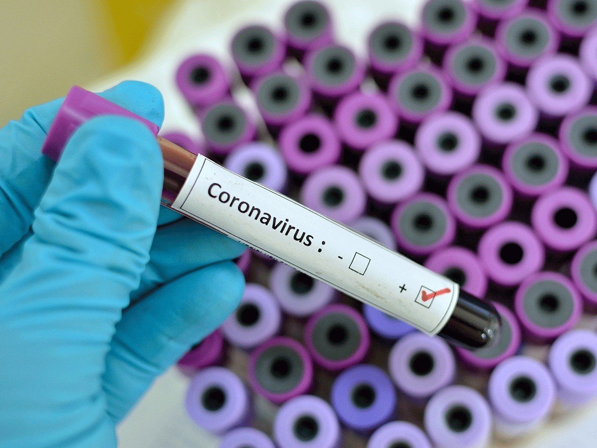 Azərbaycanda daha 7 yeni koronavirusa yoluxma qeydə alındı