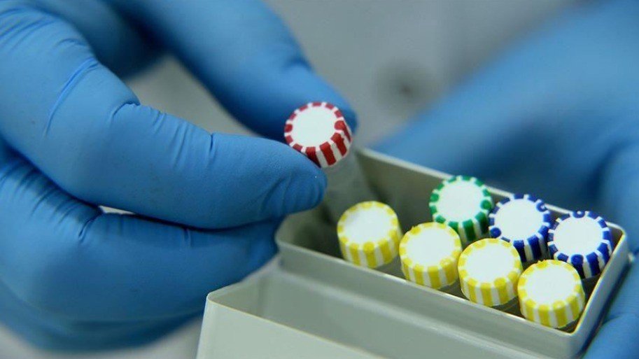 İranda koronavirusla bağlı yeni test hazırlandı