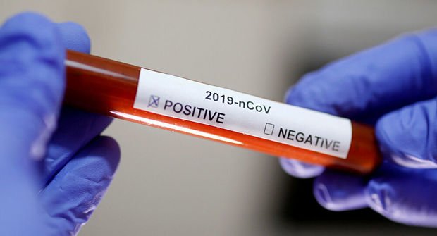 Azərbaycanda daha 273 nəfərin koronavirusa yoluxduğu aşkarlandı