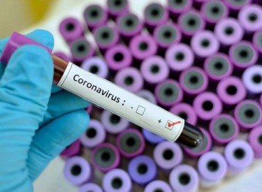 Dünyada koronavirus qurbanlarının sayı 1 milyon nəfəri ötüb